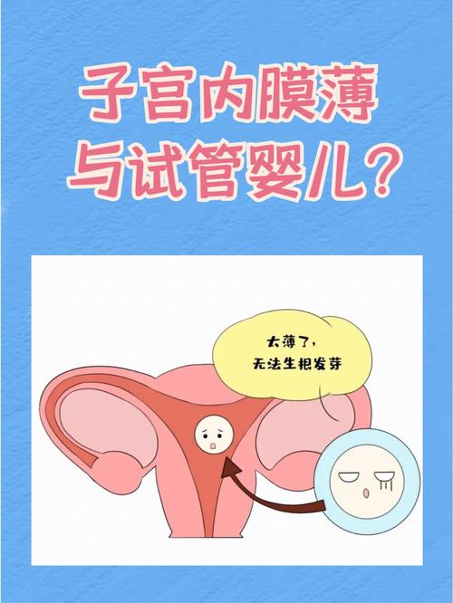 试管婴儿检查中子宫内膜ABC型是什么意思【试管婴儿检查:解读中子宫内膜ABC型】